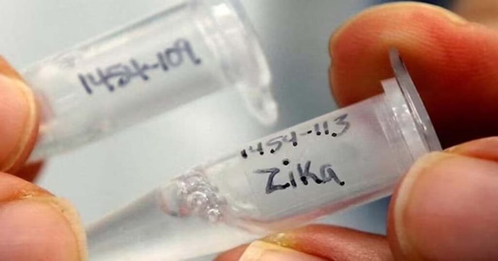 ঢাকায় জিকা ভাইরাস শনাক্ত